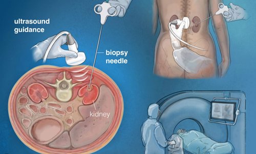 Dental Implant in Nagpur